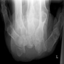 carpal.jpg