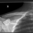 clavicula2.jpg