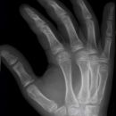 hand_schr_kind.jpg