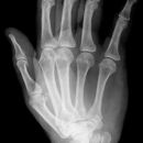 Mittelhand_seitl_1.jpg