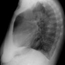 Thoraxmagen
